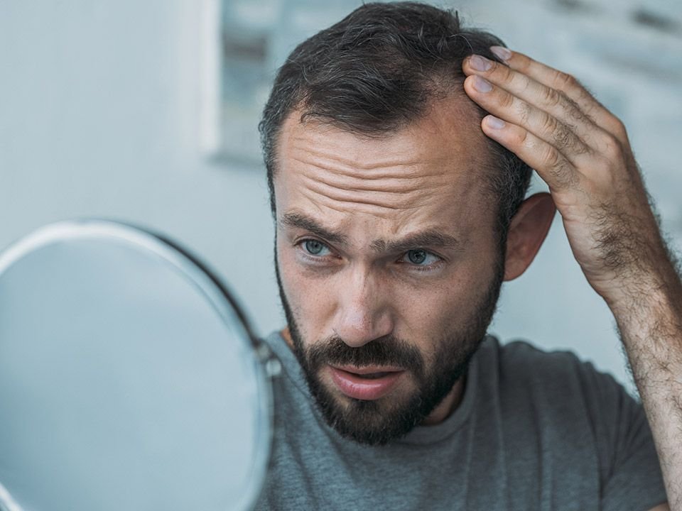 Tratamientos capilares para la caida del cabello especificos para hombre