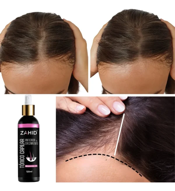 Tónico Capilar Crecimiento MINOXIDIL 2% MUJER - Imagen 2