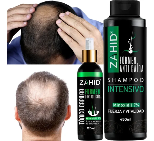 Shampoo Zahid Minoxidil Forte y Tónico Capilar - Imagen 6